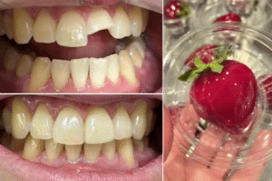 Morango do Amor pode quebrar dentes e danificar próteses, alerta Conselho de Odontologia