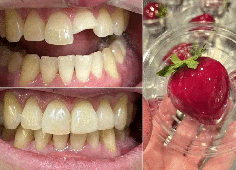 Morango do Amor pode quebrar dentes e danificar próteses, alerta Conselho de Odontologia